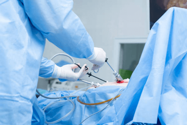 Laparoscopic Urological Surgery